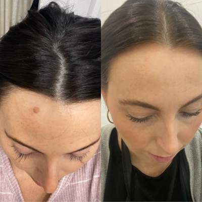 Glacial Freeze Amazing Results! 